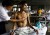 World Tuberculosis Day is today